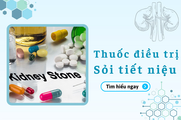 Thuốc trị sỏi tiết niệu nào tốt? 3 loại điều trị hiệu quả