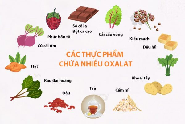 Các cách giảm đau sỏi bàng quang